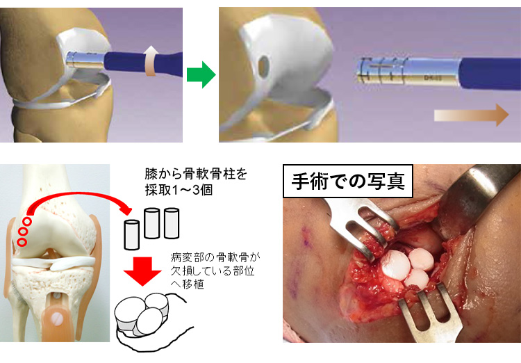 【※裁断済み】肘関節手術のすべて